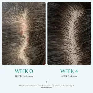 آمپول براش لیلیوئه پر پشت کننده و تقویتی scalp wellness
