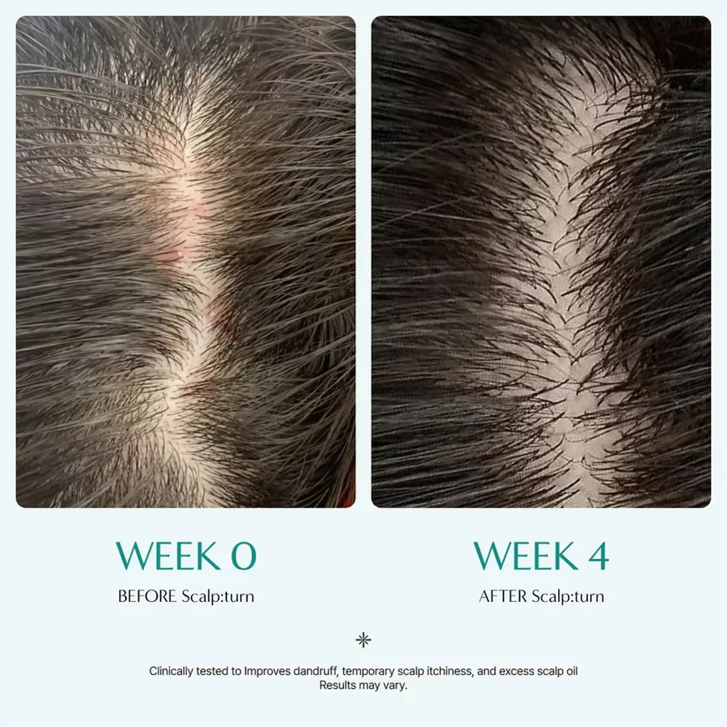آمپول براش لیلیوئه پر پشت کننده و تقویتی scalp wellness