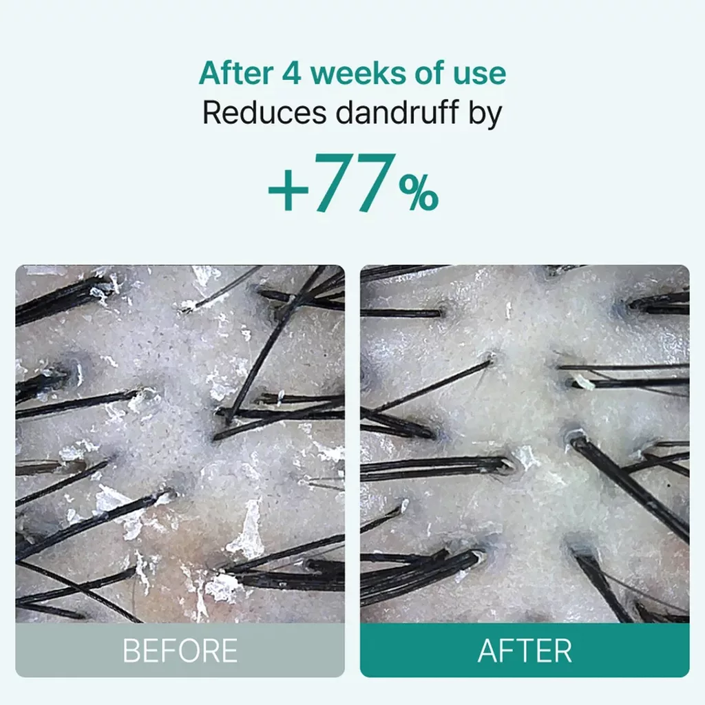 آمپول براش لیلیوئه پر پشت کننده و تقویتی scalp wellness