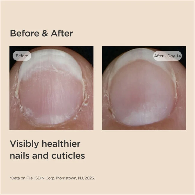 سرم تقویت ناخن ایزدین Isdin Si-Nails بدون عطر و رنگ